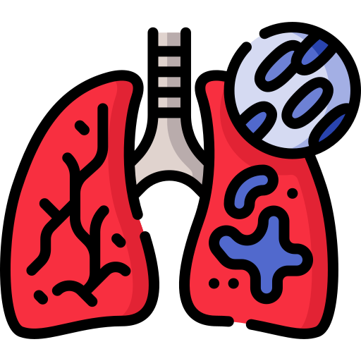 Tuberculosis